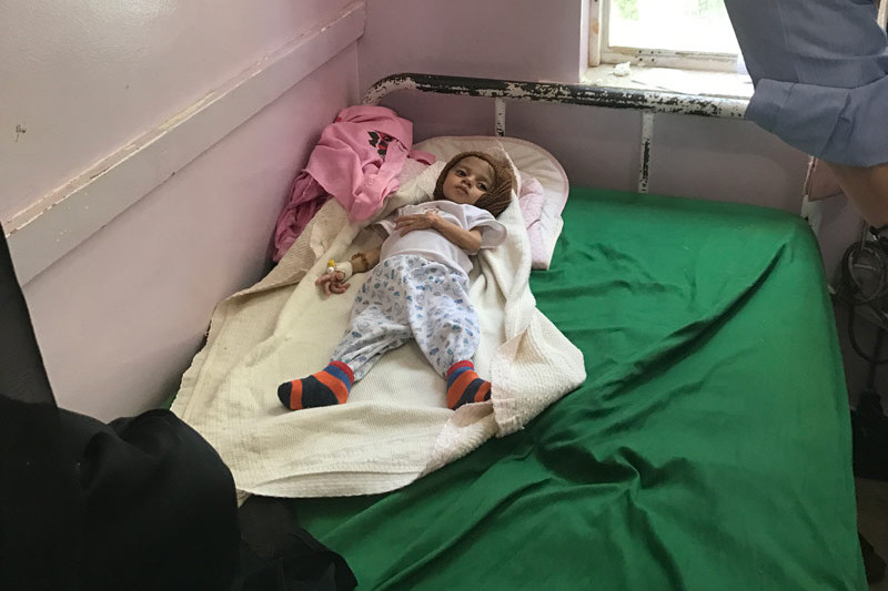 Истощенный ребенок в детской больнице в Сане, Йемен.