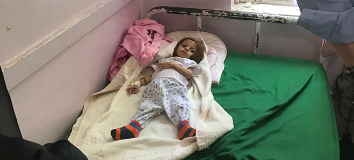 Un enfant souffrant de malnutrition dans un hôpital à Sanaa, la capitale du Yémen.