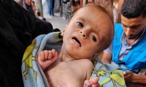 Salam, de seis meses, es examinado por desnutrición en un punto médico de la UNRWA en la ciudad de Gaza.
