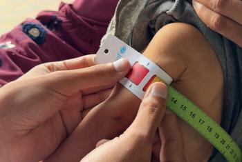 Salam, de seis meses de edad, es sometida a un examen para detectar malnutrición en un centro médico de la UNRWA en la ciudad de Gaza.