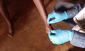 WHO is scaling up response to curb a growing mpox outbreak in the African region.