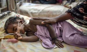 A young girl is treated in a hospital in Khartoum.