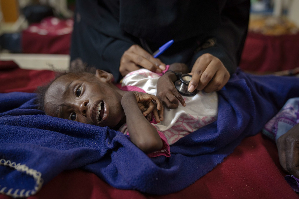 A three-year-old is treated for malnutrition at a hospital in Omdurman, Sudan.