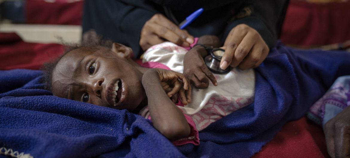 A three-year-old is treated for malnutrition at a hospital in Omdurman, Sudan. A three-year-old is treated for malnutrition at a hospital in Omdurman, Sudan.