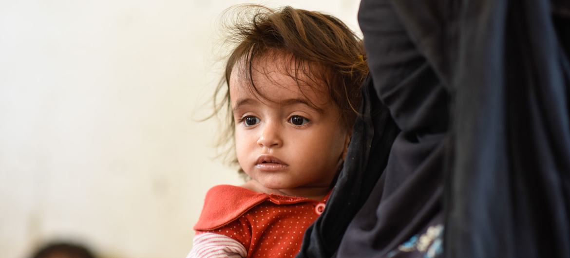 一位母亲带着她的孩子来到也门哈杰的流动医疗诊所。