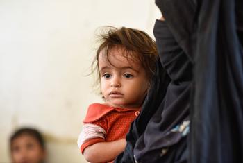 یمن کے علاقے حجا میں ایک ماں اپنی بچی کو علاج کے لیے گشتی طبی سہولت لائی ہے۔