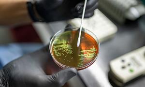 Scientists in Argentina study bacteria samples to track and control the emergence of antimicrobial resistance (AMR).