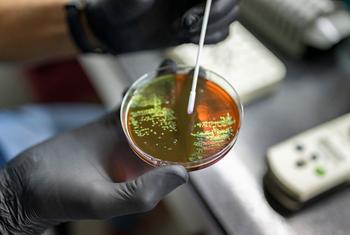 Cientistas na Argentina estudam amostras de bactérias para rastrear e controlar o surgimento de resistência antimicrobiana