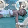 A malnourished baby is treated at the Al Helou Hospital in Gaza City.