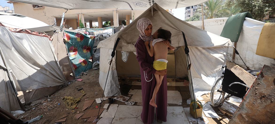 A displaced mother struggles to address the complex needs of her seven-year-old severely malnourished daughter with cerebral atrophy. A displaced mother struggles to address the complex needs of her seven-year-old severely malnourished daughter with cerebral atrophy.