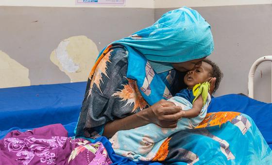 A newborn child at a nutrition centre in Bentiu, South Sudan.