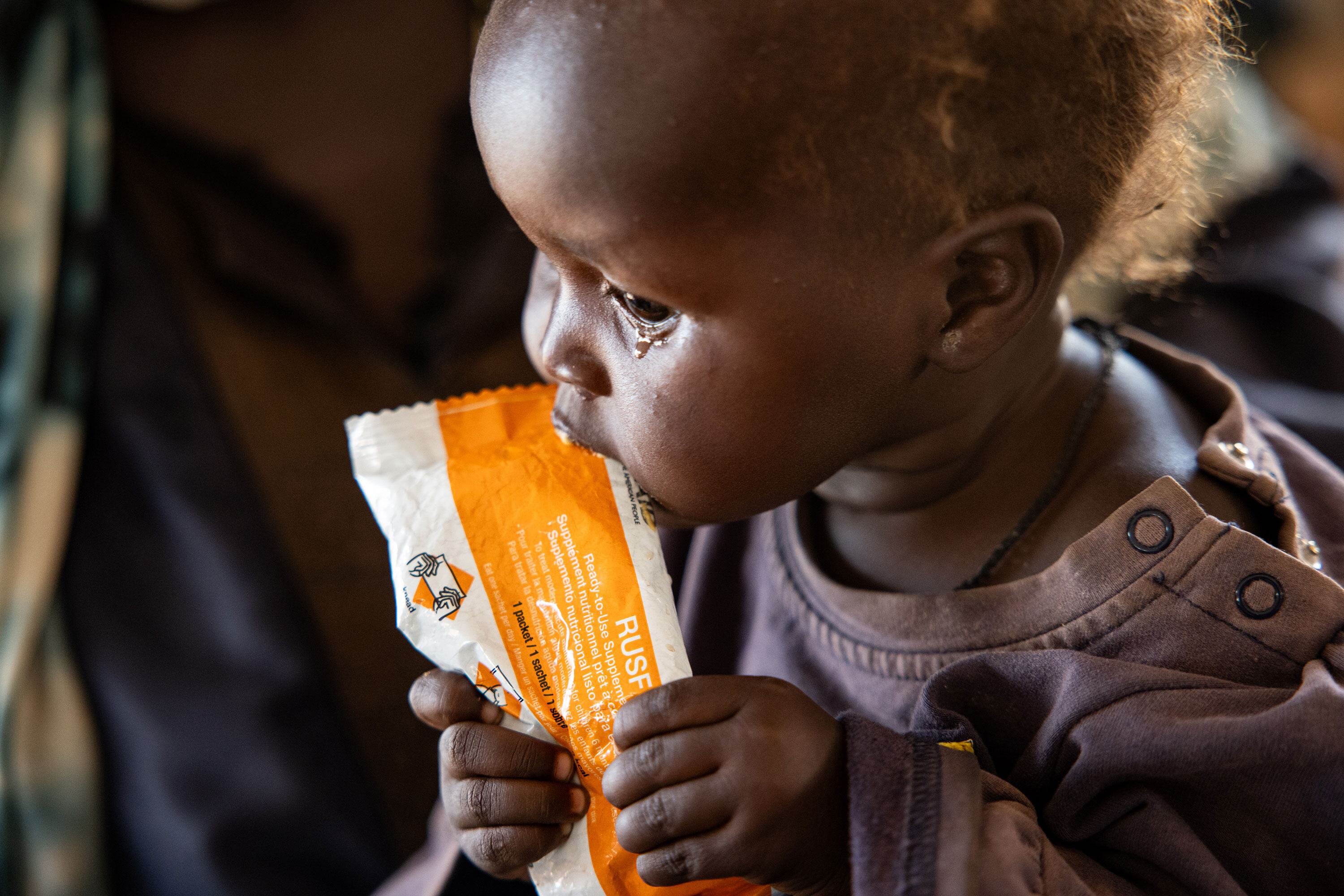 Маленький ребенок в Южном Судане, получающий лечение от недоедания в клинике по питанию Всемирной продовольственной программы, с оранжевым пакетом RUTF (Ready-to-Use Therapeutic Food).