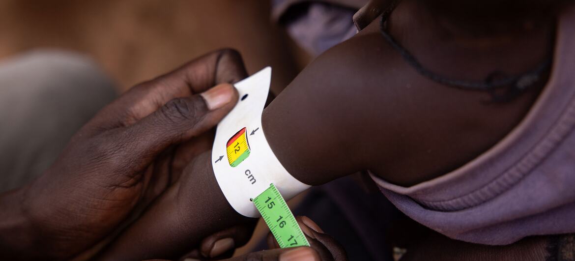 Un primer plano de un trabajador sanitario midiendo la circunferencia del brazo de un niño pequeño con una cinta de medición y una tarjeta MUAC de la OMS en una clínica de nutrición en Aweil, Sudán del Sur.