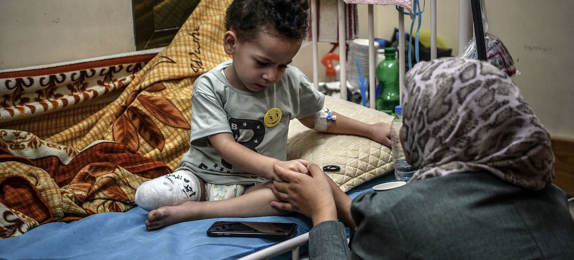 Menino de 3 anos, cuja casa foi bombardeada, se recupera no hospital Nasser após a amputação de parte de sua perna direita