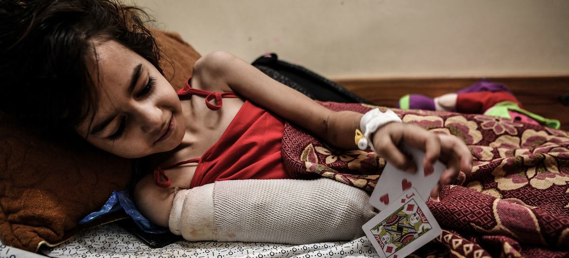 Een jong meisje uit Gaza-stad herstelt van de amputatie van een deel van haar arm na een raketaanval op haar huis.
