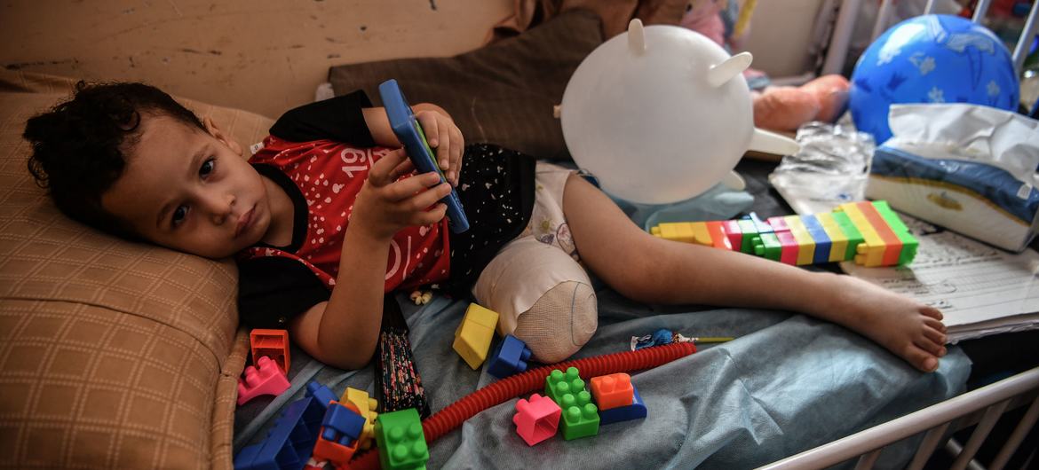 Um menino de 3 anos se recupera depois de ter a perna amputada após um ataque direto com mísseis contra sua casa na cidade de Nuseirat, no centro da Faixa de Gaza