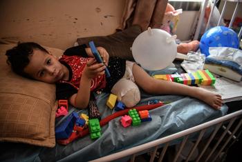 A 3-year-old boy recovers after having his leg amputated following a direct missile strike on his home in Nuseirat city in the central Gaza Strip. (file)