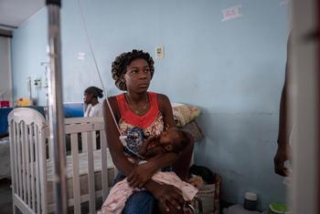 Un niño desnutrido recibe tratamiento en el Hôpital universitaire Justinien de Cap Haitien, Haití.