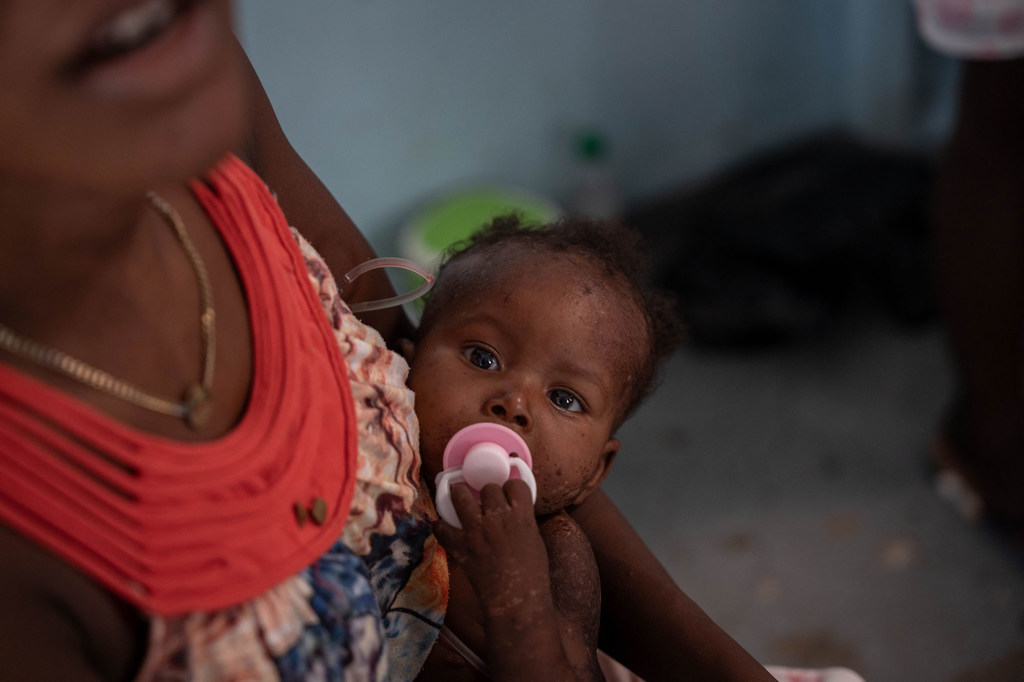 Une mère et son bébé visitent l'Hôpital universitaire Justinien au Cap-Haïtien, en Haïti.