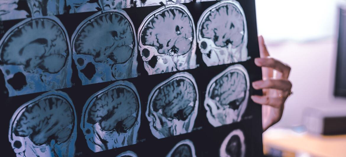 New guidance offers hope for reducing the global toll of dementia