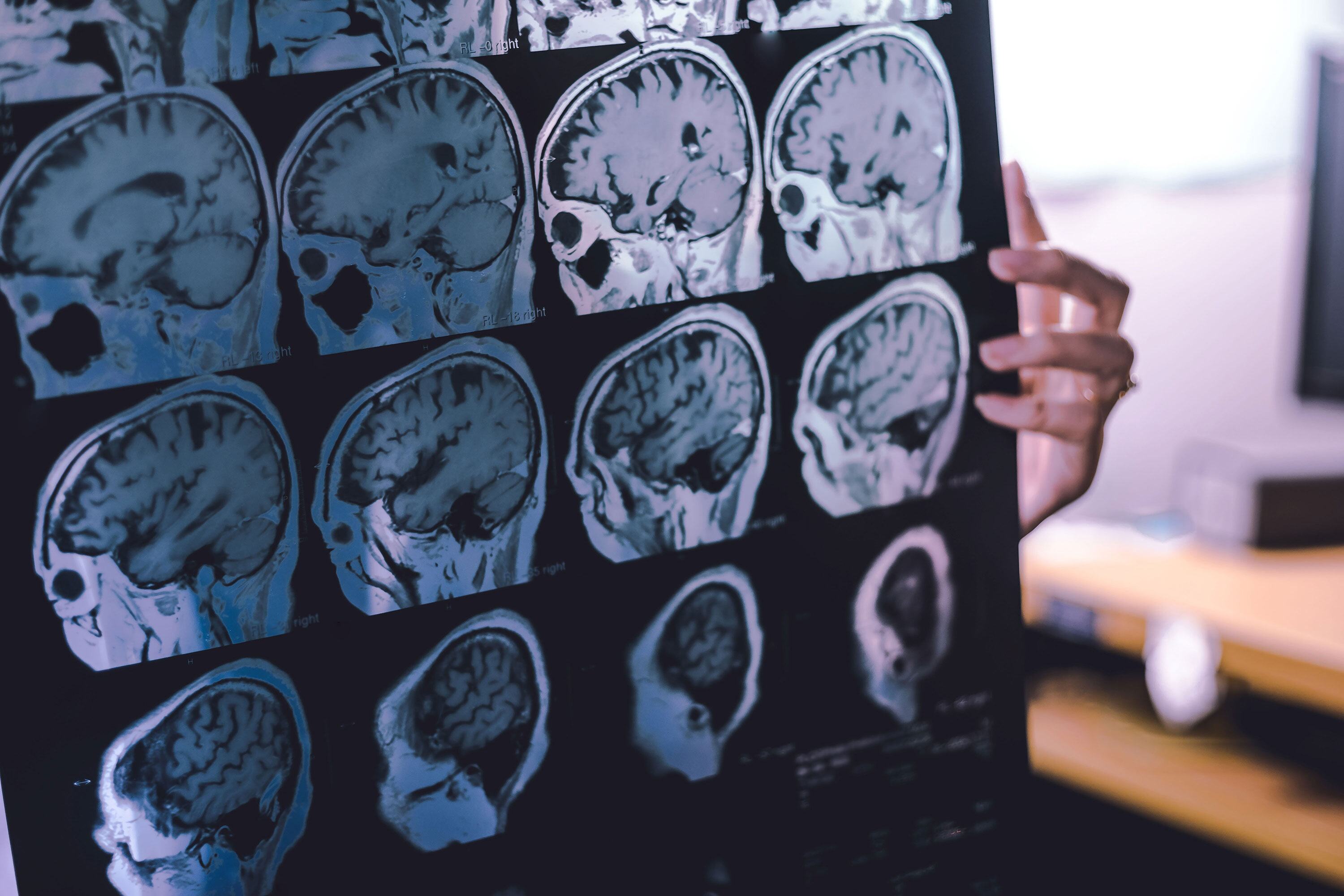 OMS afirma que até 45% do risco de demência pode ser prevenido ou adiado episode artwork