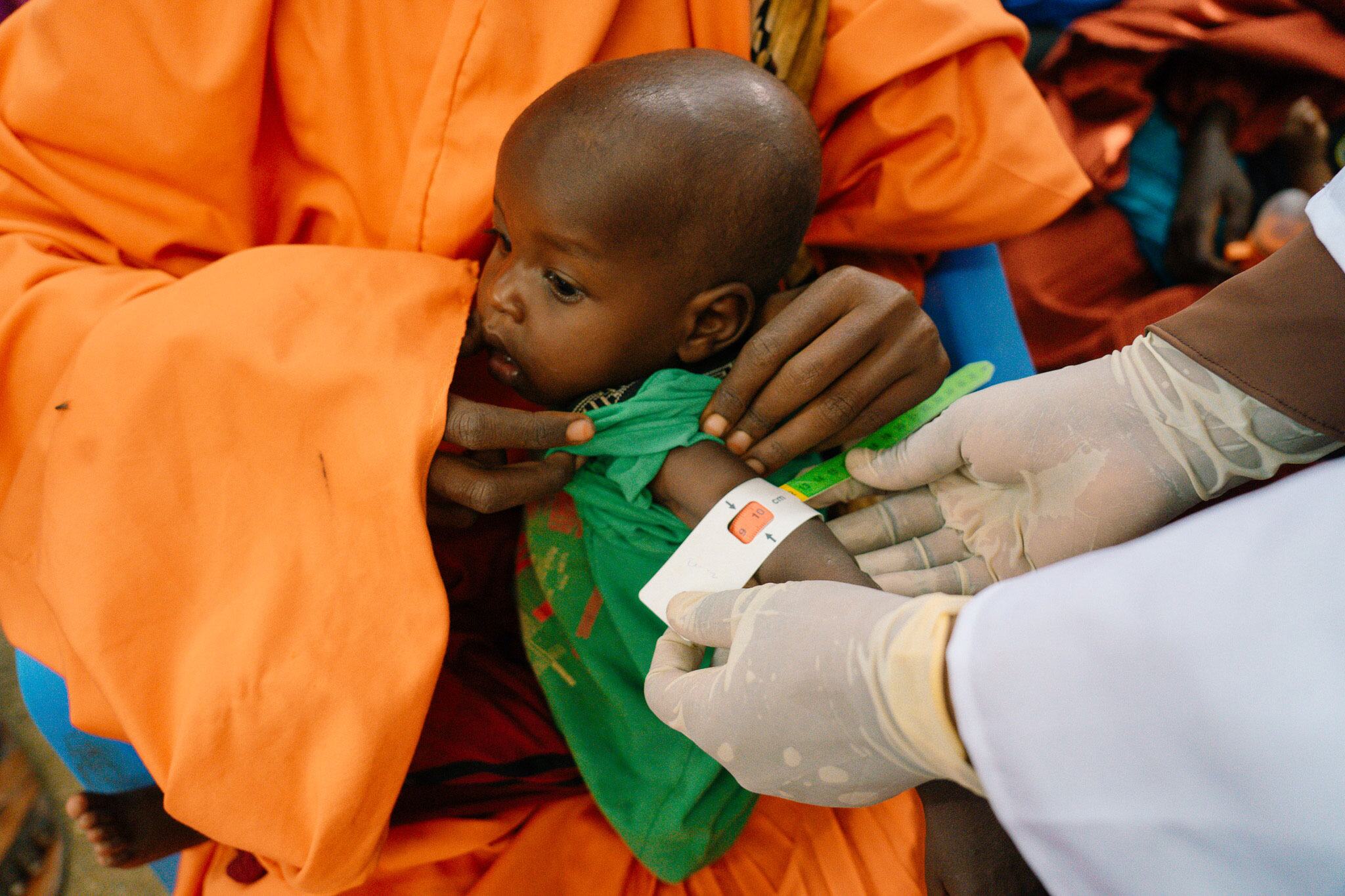 يقوم أحد العاملين في WFP بقياس ذراع طفل صومالي صغير يحمله أحد مقدمي الرعاية في بورهاكابا.