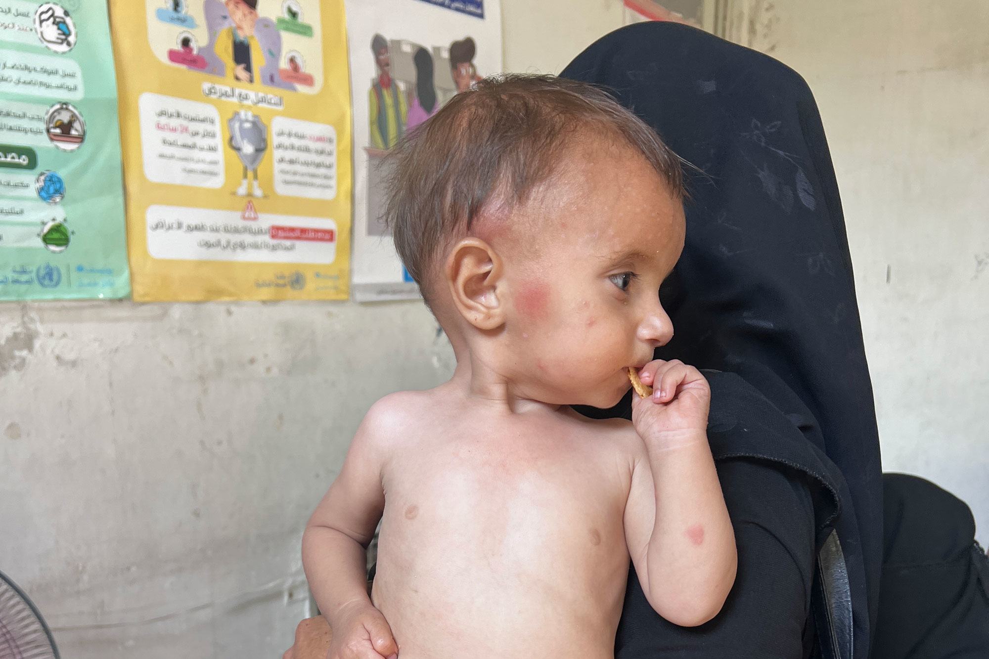 Une mère et son enfant attendent dans une clinique de malnutrition à Alep, dans le nord-ouest de la Syrie. Plus de 9 millions de personnes souffrent d’insécurité alimentaire aiguë dans le pays.