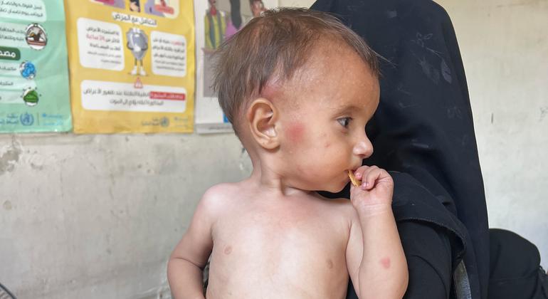 أم وطفلها ينتظران في عيادة لعلاج سوء التغذية في حلب، سوريا.