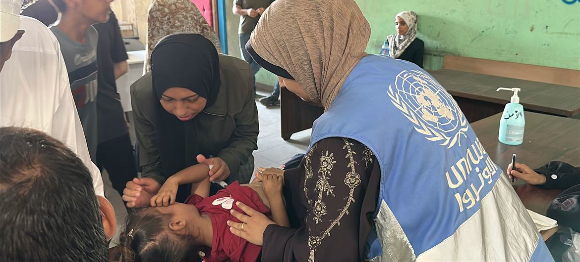 Una trabajadora de salud de la UNRWA examina a un niño con desnutrición en la ciudad de Gaza.
