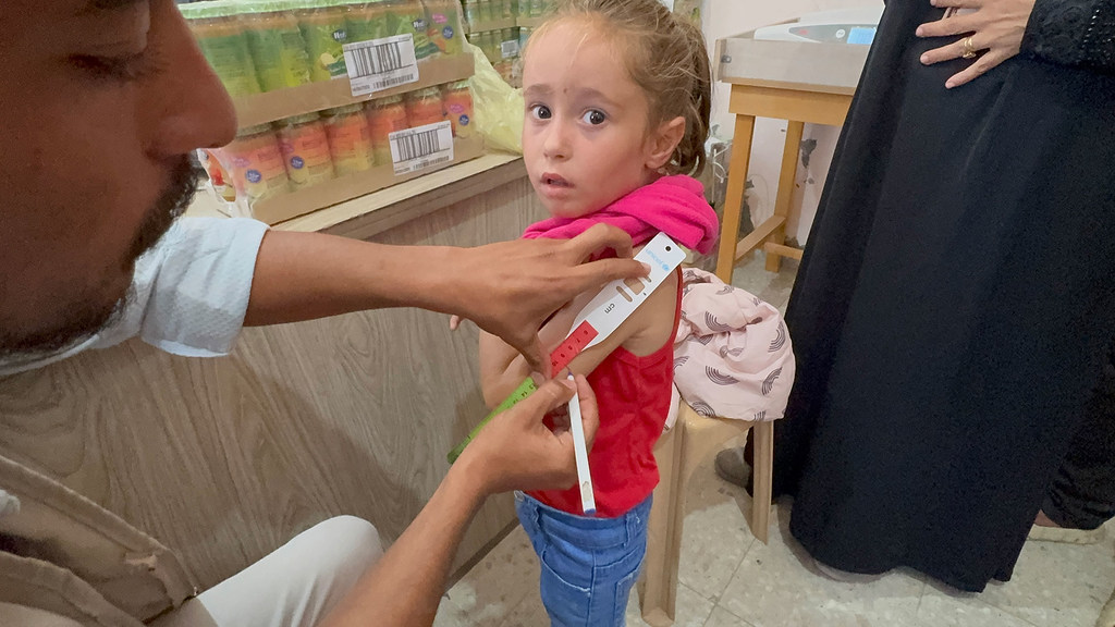 Una niña de Gaza es examinada para detectar signos de desnutrición.