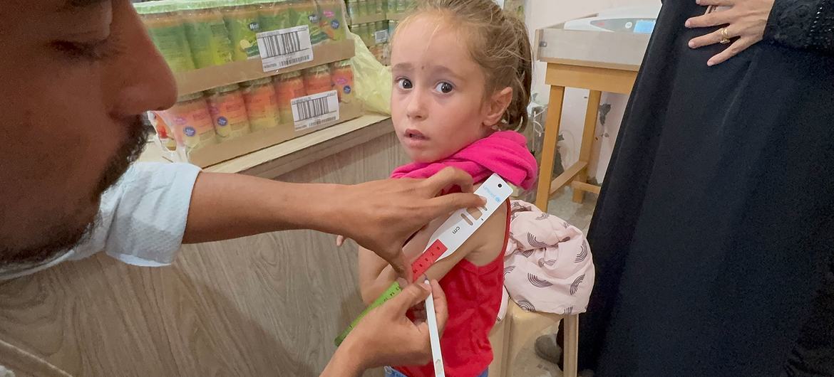 Una niña de Gaza es examinada para detectar signos de desnutrición.