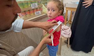 Una niña de Gaza es examinada para detectar signos de desnutrición.