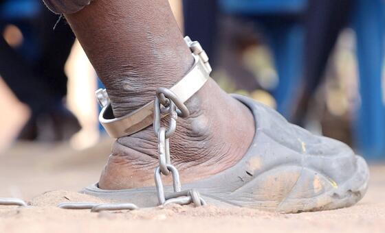 Primer plano del tobillo de un detenido con una cadena metálica y esposas.