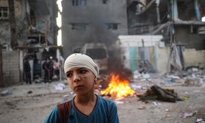 Un niño con la cabeza vendada en Rafah, al sur de la Franja de Gaza.