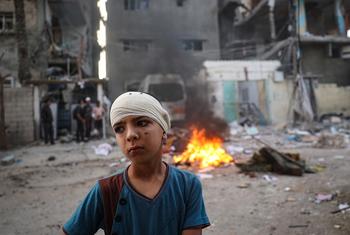 A boy, his head in bandages, stands in Rafah in the south of the Gaza Strip.