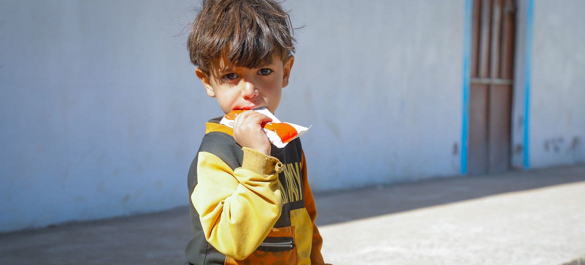 Uma criança desnutrida recebe tratamento em uma clínica móvel apoiada pela Unicef em Dhamar, Iêmen Uma criança desnutrida recebe tratamento em uma clínica móvel apoiada pela Unicef em Dhamar, Iêmen