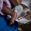 Le pied d'un bébé est tenu par un agent de santé portant des gants pour un prélèvement sanguin destiné à un test PCR de dépistage du VIH à la clinique de Kaboko, dans la ville de Kisenga, en RDC.