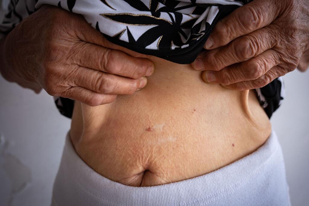 Close-up del torso de una mujer mayor que muestra una cicatriz en su abdomen, las manos levantando su camisa para revelar la marca, simbolizando el trauma de la violencia sexual durante la guerra en Ucrania.