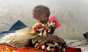 Three-year-old Shimba, who suffers from severe acute malnutrition, drinks therapeutic milk at the UNICEF-supported Port Sudan Pediatric Hospital.