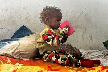 Three-year-old Shimba, who suffers from severe acute malnutrition, drinks therapeutic milk at the UNICEF-supported Port Sudan Pediatric Hospital.