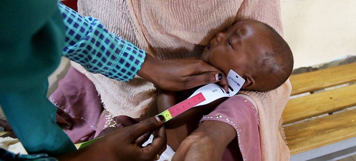 Un bébé de six mois est soumis à un dépistage de la malnutrition lors d'une visite à l'hôpital dans l'État du Nil Bleu, au Soudan.