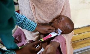 A six-month-old baby is screened for malnutrition during a visit to the hospital in Blue Nile state, Sudan.