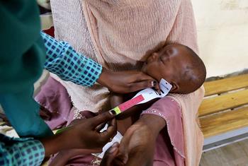 Un bébé de six mois est soumis à un dépistage de la malnutrition lors d'une visite à l'hôpital dans l'État du Nil Bleu, au Soudan.