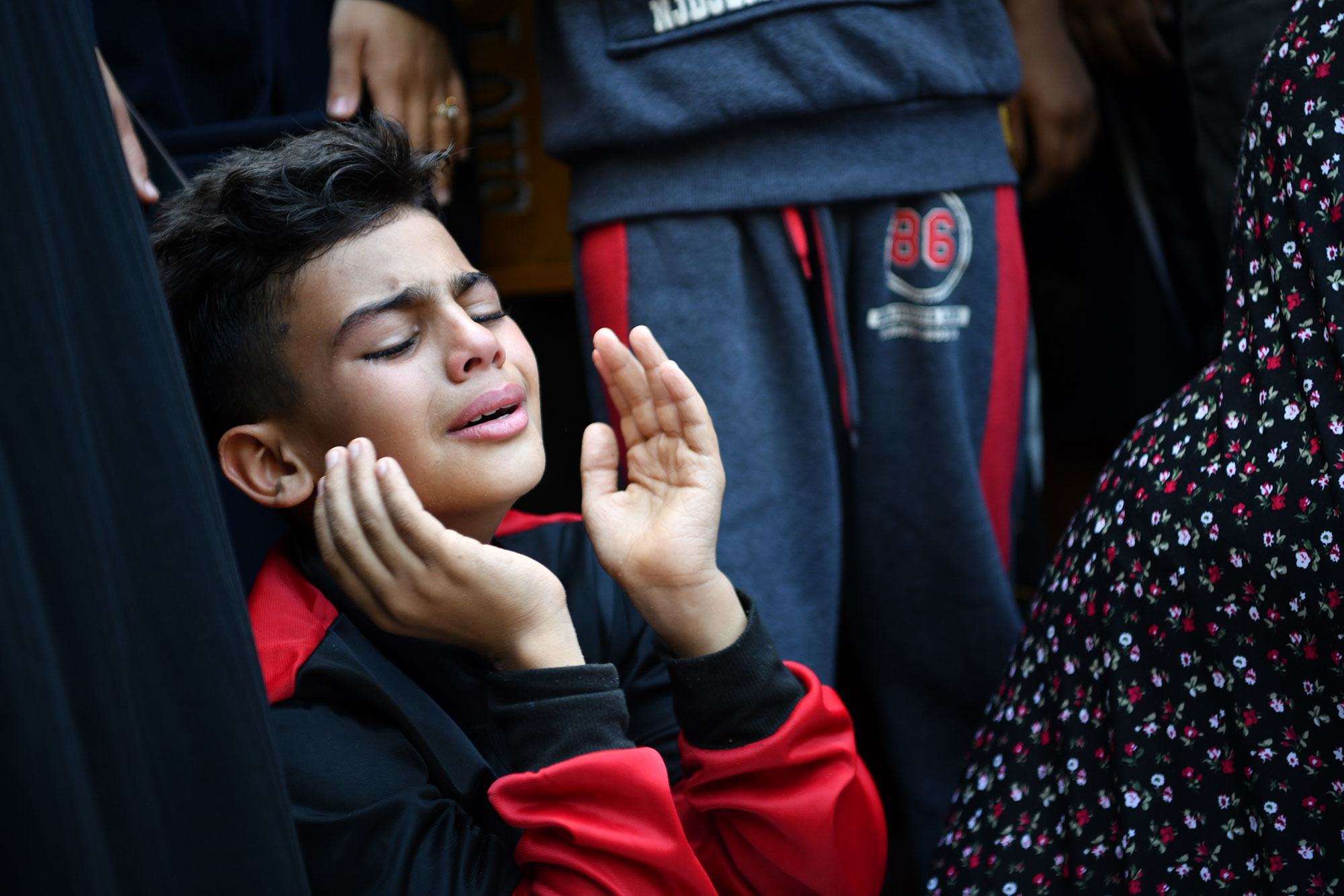 Gaza: Children flooding hospitals bearing ‘wounds of war’