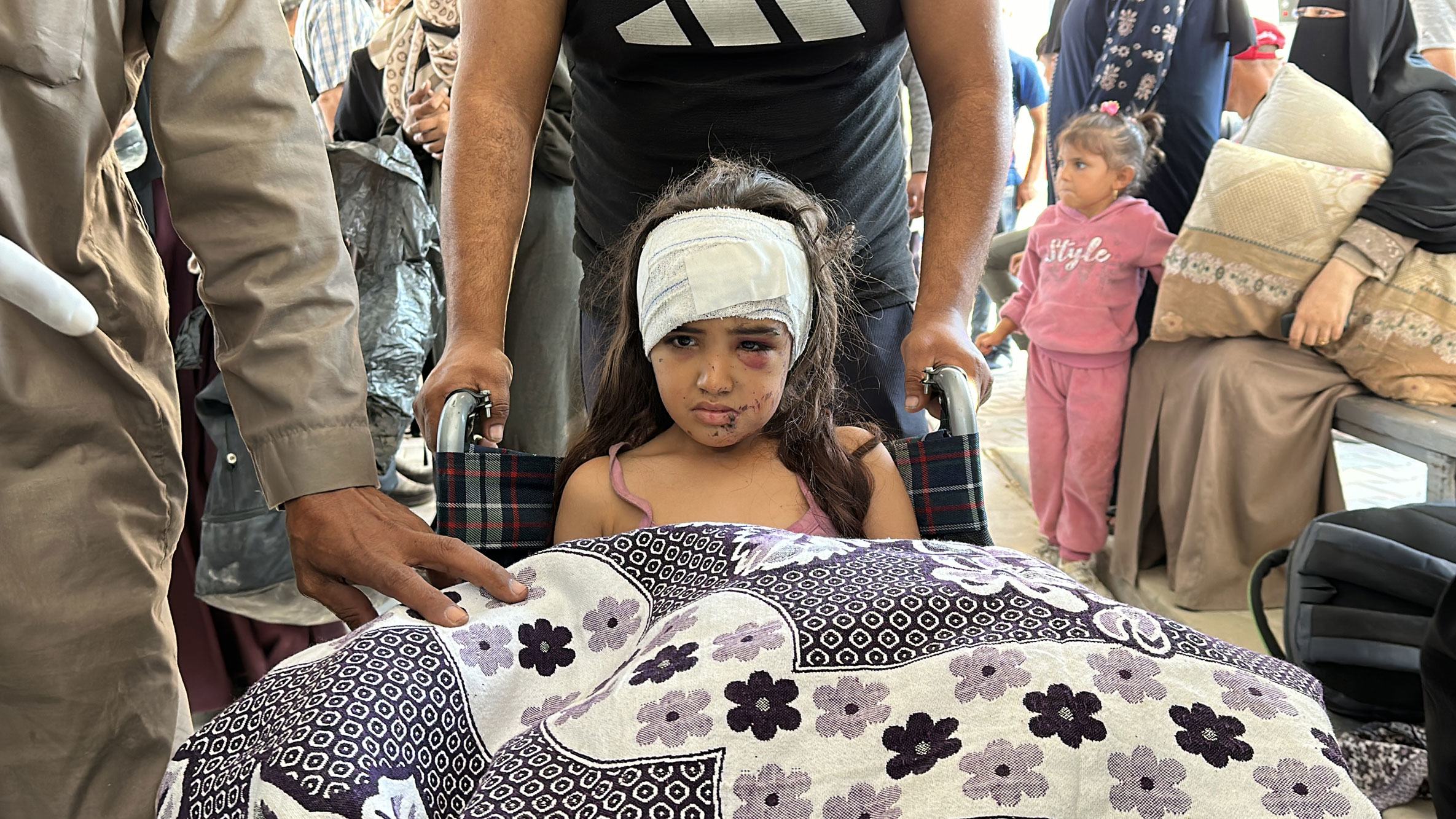 Una misión conjunta de la ONU en el norte de Gaza ayudó a trasladar a algunos pacientes, como esta niña, del Hospital Kamal Adwan al Hospital Al-Shifa.