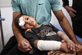 Ayman Abu Hujair, de cinco años, recibe tratamiento luego de ser herido en un bombardeo a una escuela que servía de refugio en Gaza. (Foto de archivo, mayo 2025)