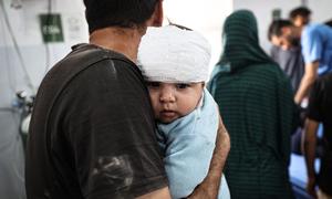 Un bebé de ocho meses recibe tratamiento en el hospital Al-Awda del campo de Nuseirat, en Gaza.