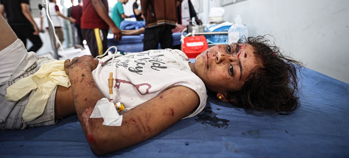 Une jeune fille reçoit des soins après avoir été touchée par une frappe aérienne à Gaza.
