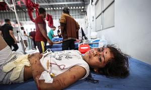 Una niña recibe tratamiento tras quedar atrapada en un ataque aéreo sobre Gaza.