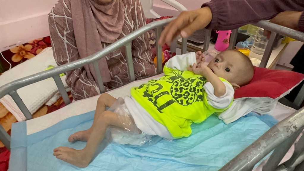 Un recién nacido recibe tratamiento por desnutrición en el hospital Nasser de Gaza.